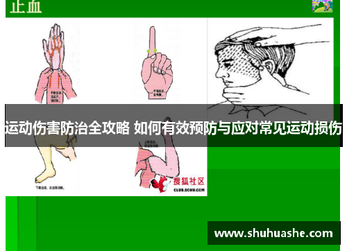运动伤害防治全攻略 如何有效预防与应对常见运动损伤 运动伤害防治全攻略 如何有效预防与应对常见运动损伤